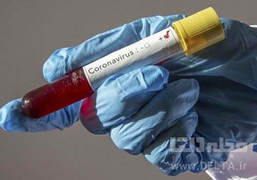 آیا ویروس کرونا از مردان بیشتر تلفات می گیرد؟